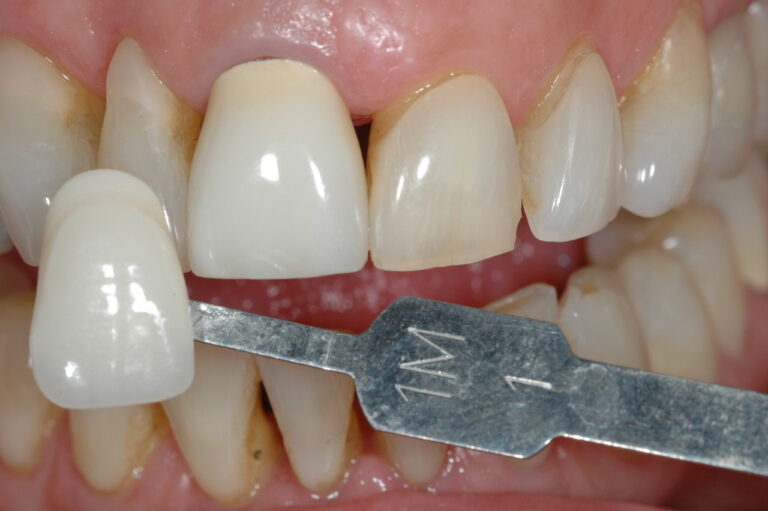 Our plans complete, it’s a Sawadee-Ka and many thanks to Yanhee International Hospital for another job well done! 